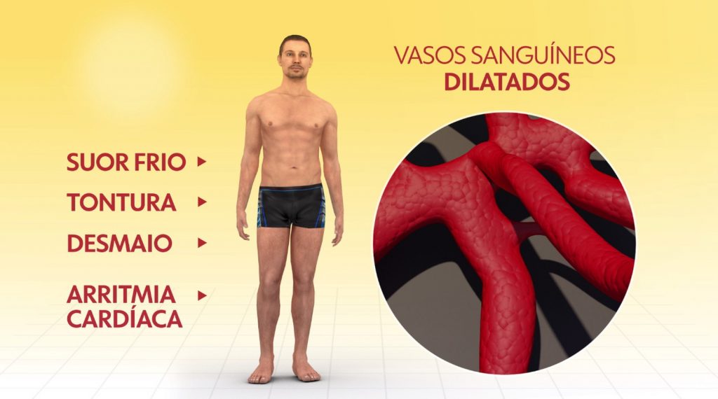 Calorão pode aumentar o risco de infarto para quem sofre do coração