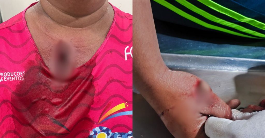 Briga por som alto termina com machadadas em mãe e filha